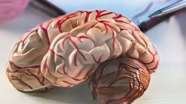 Vivir con Esclerosis Múltiple en RD: El desafío de costear un diagnóstico de «mil caras»